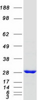 protq9ul25 rab21 human recombinant protein