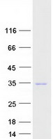 Coomassie blue staining of purified RAB23 protein