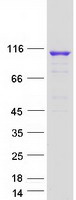 protq9uld0 ogdhl human recombinant protein