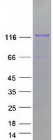 protq9uld5 znf777 human recombinant protein