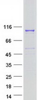 Coomassie blue staining of purified PALD1 protein