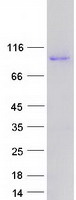 Coomassie blue staining of purified PNMA8B protein