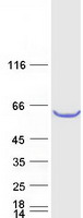 protq9ulp9 tbc1d24 human recombinant protein