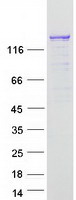 protq9ulv3 ciz1 human recombinant protein