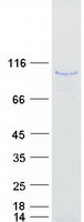 protq9ulx6 akap8l human recombinant protein