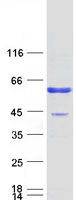 Coomassie blue staining of purified CA14 protein