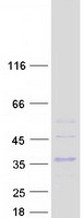 Coomassie blue staining of purified CLEC4E protein