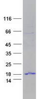 Coomassie blue staining of purified TP53TG3 protein