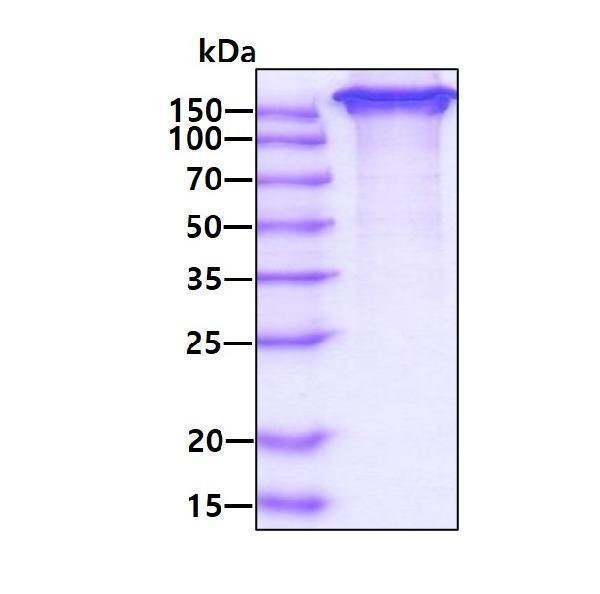 3ug by SDS-PAGE under reducing condition and visualized by coomassie blue stain