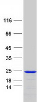 Coomassie blue staining of purified SNX12 protein