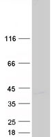 Coomassie blue staining of purified DIMT1 protein