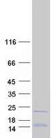 protq9unx3 rpl26l1 human recombinant protein
