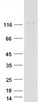 Coomassie blue staining of purified PPP6R1 protein