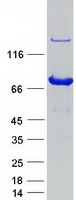 protq9upt5 exoc7 human recombinant protein