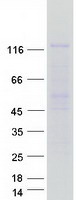 protq9upz3 hps5 human recombinant protein