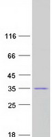 protq9uqn3 chmp2b human recombinant protein