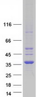 protq9y232 cdyl human recombinant protein