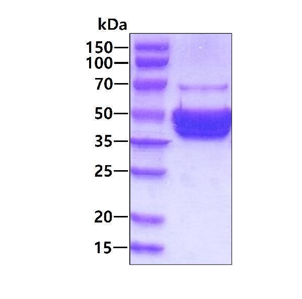 3ug by SDS-PAGE under reducing condition and visualized by coomassie blue stain