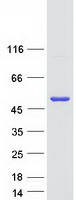 Coomassie blue staining of purified CHKB protein