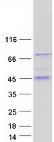 Coomassie blue staining of purified B3GALT5 protein