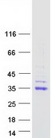Coomassie blue staining of purified CA5B protein