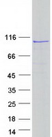 Coomassie blue staining of purified EXOC6B protein