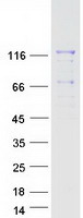 protq9y2e5 man2b2 human recombinant protein