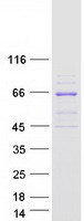 protq9y2i7 pip5k3 pikfyve human recombinant protein