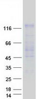 protq9y2k6 usp20 human recombinant protein