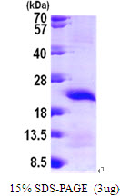 3ug by SDS-PAGE under reducing condition and visualized by coomassie blue stain