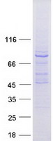 Coomassie blue staining of purified MTO1 protein