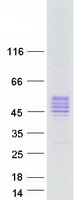 Coomassie blue staining of purified KLK5 protein
