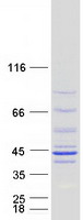 protq9y375 ndufaf1 human recombinant protein