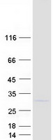 protq9y3c4 tprkb human recombinant protein