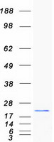 protq9y3d2 msrb2 human recombinant protein
