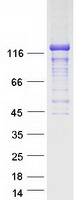 Coomassie blue staining of purified STARD13 protein