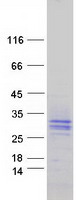 Coomassie blue staining of purified SIT1 protein