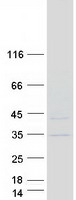 Coomassie blue staining of purified KNSTRN protein