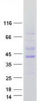 Coomassie blue staining of purified PRKAB1 protein