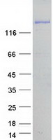 Coomassie blue staining of purified WASHC2C protein