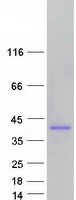 protq9y4x0 ammecr1 human recombinant protein