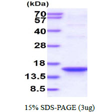 3ug by SDS-PAGE under reducing condition and visualized by coomassie blue stain.