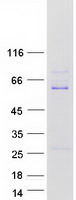 protq9y5a6 zfp38 zscan21 human recombinant protein
