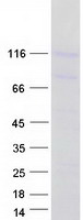 Coomassie blue staining of purified PCDHGA6 protein