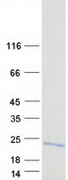 protq9y5j9 timm8b human recombinant protein