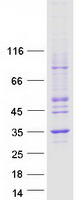 protq9y5y2 nubp2 human recombinant protein
