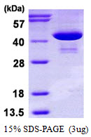 protq9y617 sdspage human psat1 recombinant protein