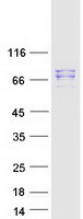 Coomassie blue staining of purified MAD1L1 protein