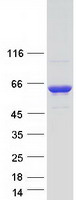 Coomassie blue staining of purified STK24 protein