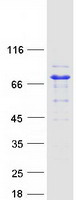 Coomassie blue staining of purified AK5 protein